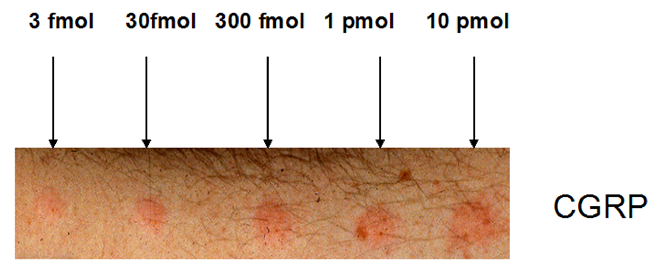 Figure-1-CGRP-Human-Responses-in-the-forearm-01.png